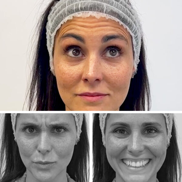 cabecera_bye_bye_arrugas_tienda BYE BYE ARRUGAS: Rejuvenece frente, entrecejo y patas de gallo