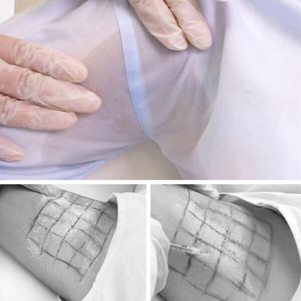 cabecera_hiperhidrosis_tienda STOP EXCESO DE SUDOR: El infalible contra la hiperhidrosis