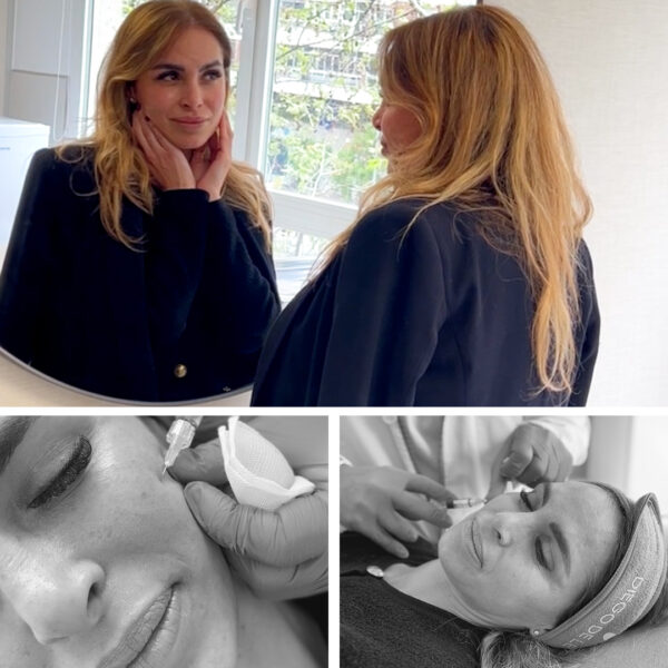 cabecera_polinucleotidos2_tienda GLOW UP · Polinucleótidos: Tu piel en su máximo esplendor