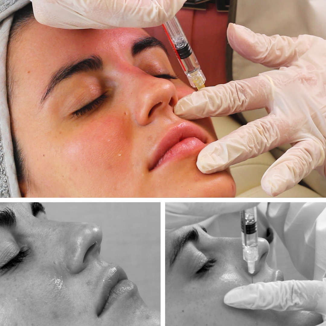 GLOW UP: Tu piel en su máximo esplendor