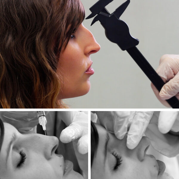 cabecera_rinomodelacion_tienda RINOMODELACIÓN: Rediseña tu nariz en 15 minutos