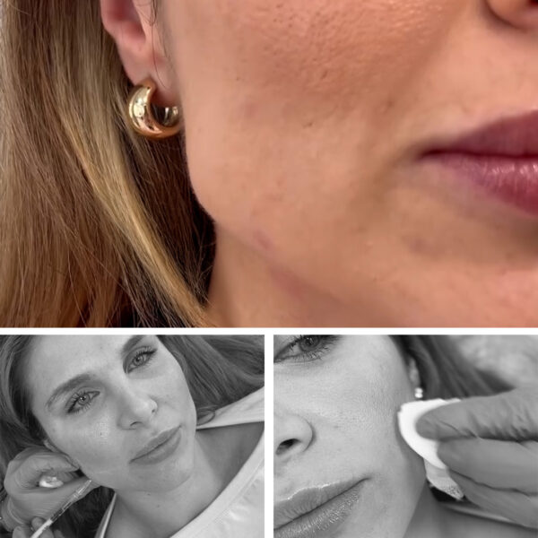 cabecera_bruxismo_tienda bruxismo-clinicas-diego-de-leon