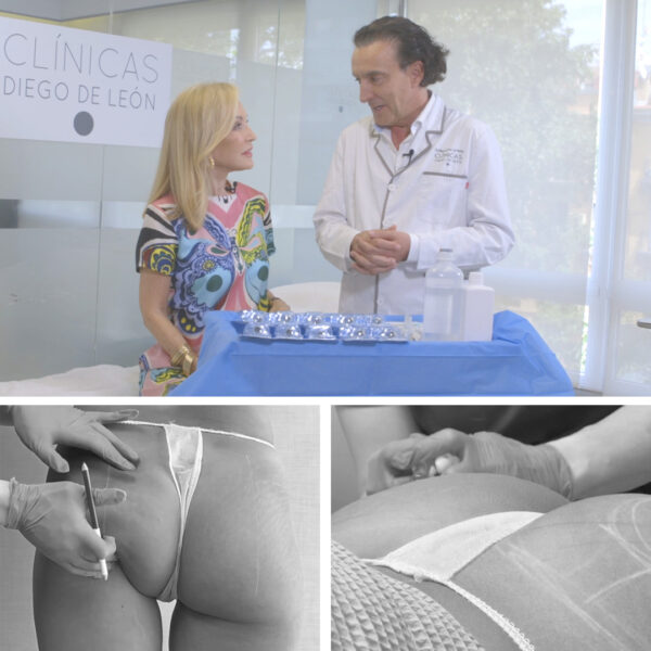 cabecera_diseño_gluteos_tienda diseño-gluteos-clinicas-diego-de-leon