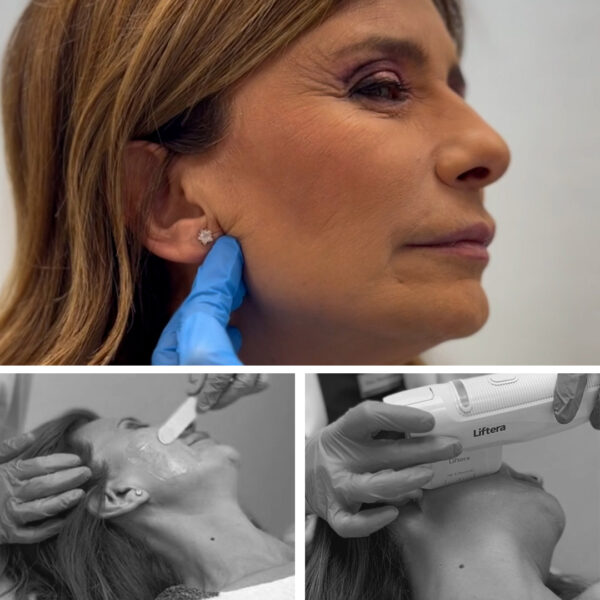 cabecera_lindsay_lift_tienda lindsay-lift-clinicas-diego-de-leon