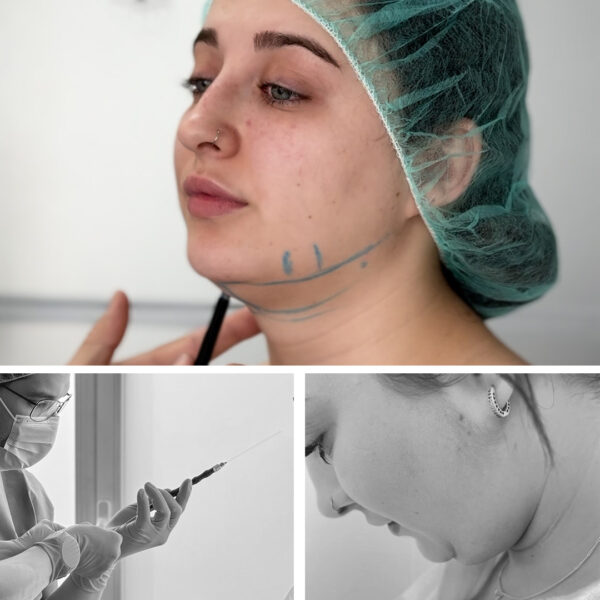 cabecera_lipolaser_tienda lipolaser-clinicas-diego-de-leon