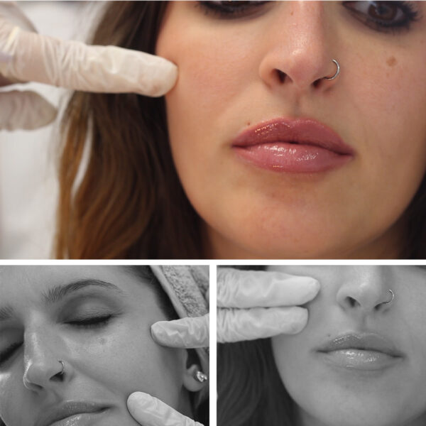 cabecera_estimuladores_colageno_tienda LIFTING 3D: Estimulador de Colágeno