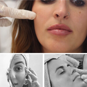 LIFTING 3D: Estimulador de Colágeno