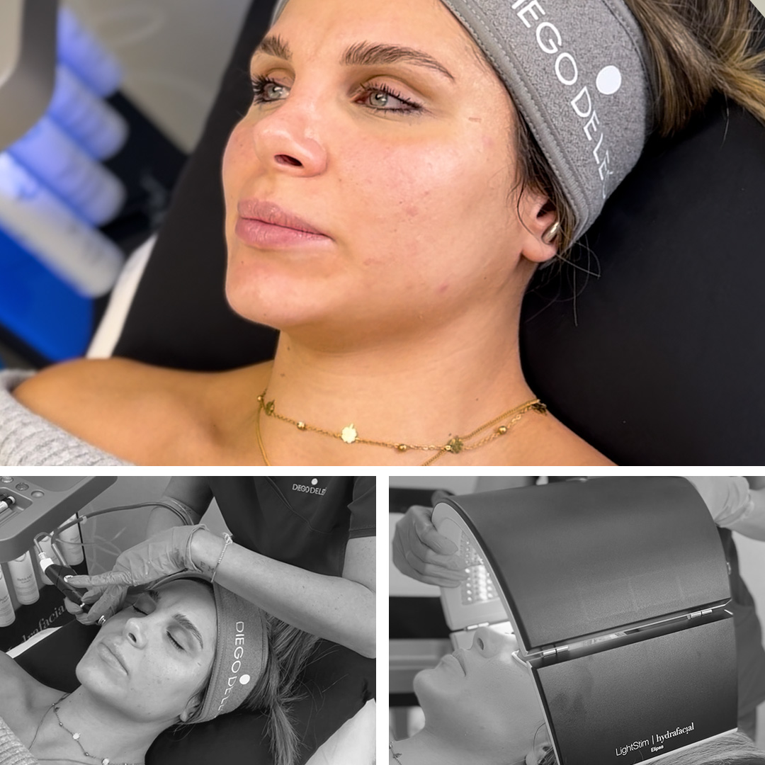 Beauty Starter Pack : Hydrafacial