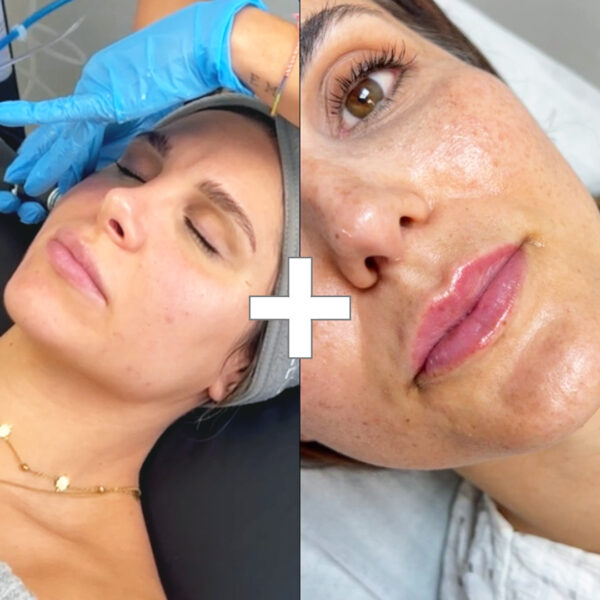 cabecera_pack_hydrafacial+labios_tienda Beauty Starter + Lips