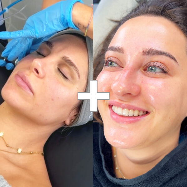 cabecera_pack_hydrafacial+skinbooster_tienda Xmas Glow Bloom