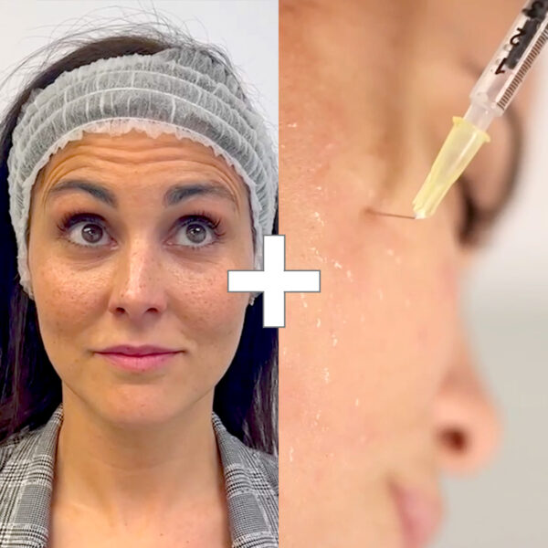 BYE BYE Arrugas + Nuestras Famosas Vitaminas