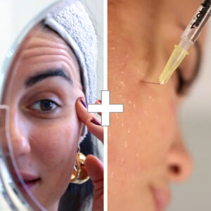 BYE BYE Arrugas + Nuestras Famosas Vitaminas